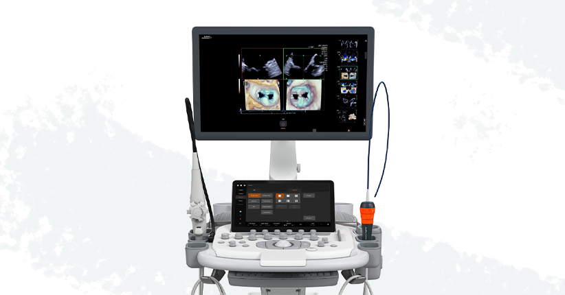 Acuson Origin Ultrasound